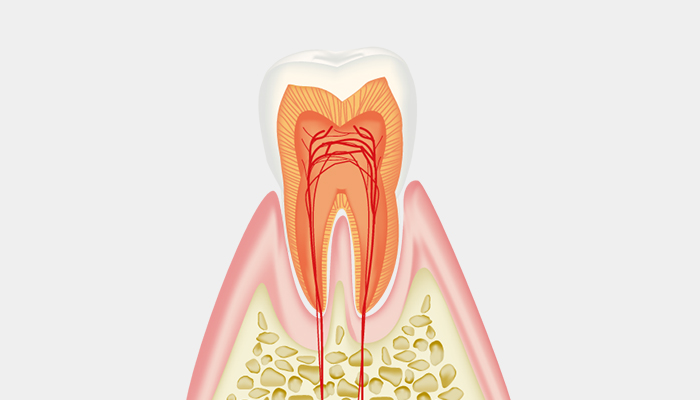 C0:再石灰化が期待できる初期虫歯